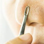 4 Perawatan Alami Usir Komedo di Hidung