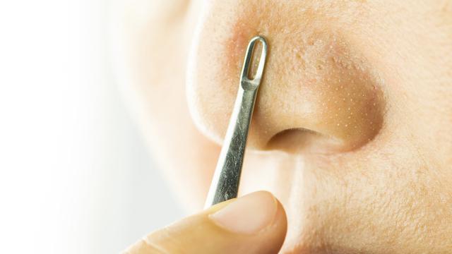 4 Perawatan Alami Usir Komedo di Hidung