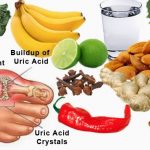 Ingin Sembuh dari Penyakit Asam Urat? Berikut Cara Alami ynag dapat di tempuh