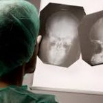 Apakah Anak Saya Mengalami Gegar Otak?