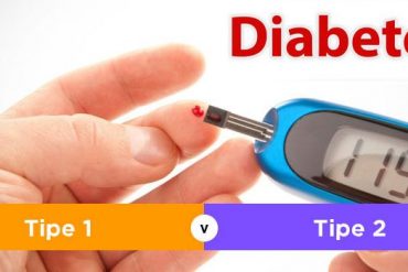 Jenis-Jenis Diabetes Insipiditus