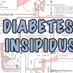 Diabetes Insipidus