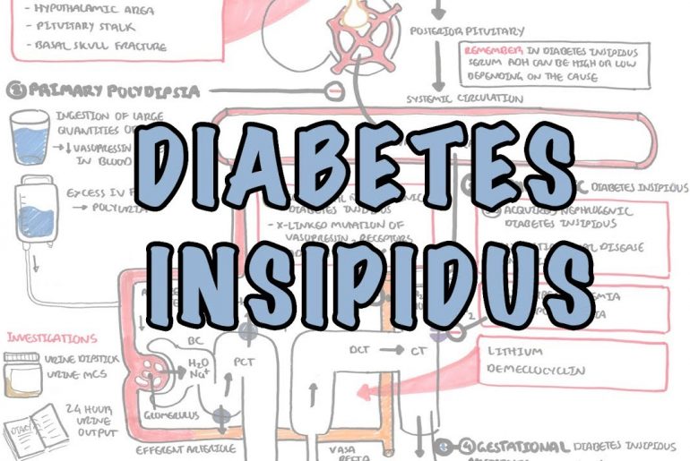 Diabetes Insipidus