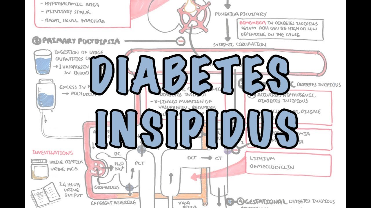 Pencegahan diabetes insipidus