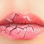 7 Hal Ini Membuat Bibirmu Semakin Kering