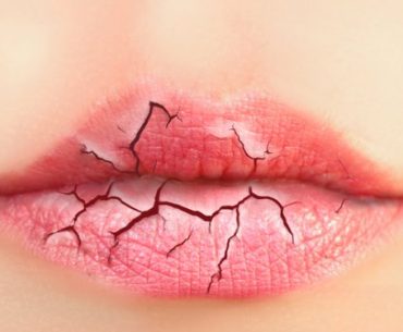 7 Hal Ini Membuat Bibirmu Semakin Kering